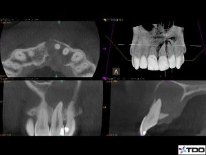 central-texas-endodontics-conebeam-cbct-300x225 central-texas-endodontics-conebeam-cbct-300x225